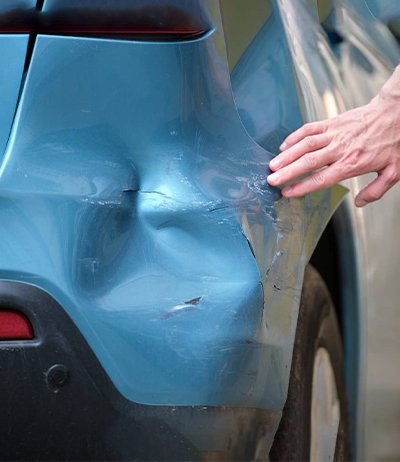 Paintless Dent Removal